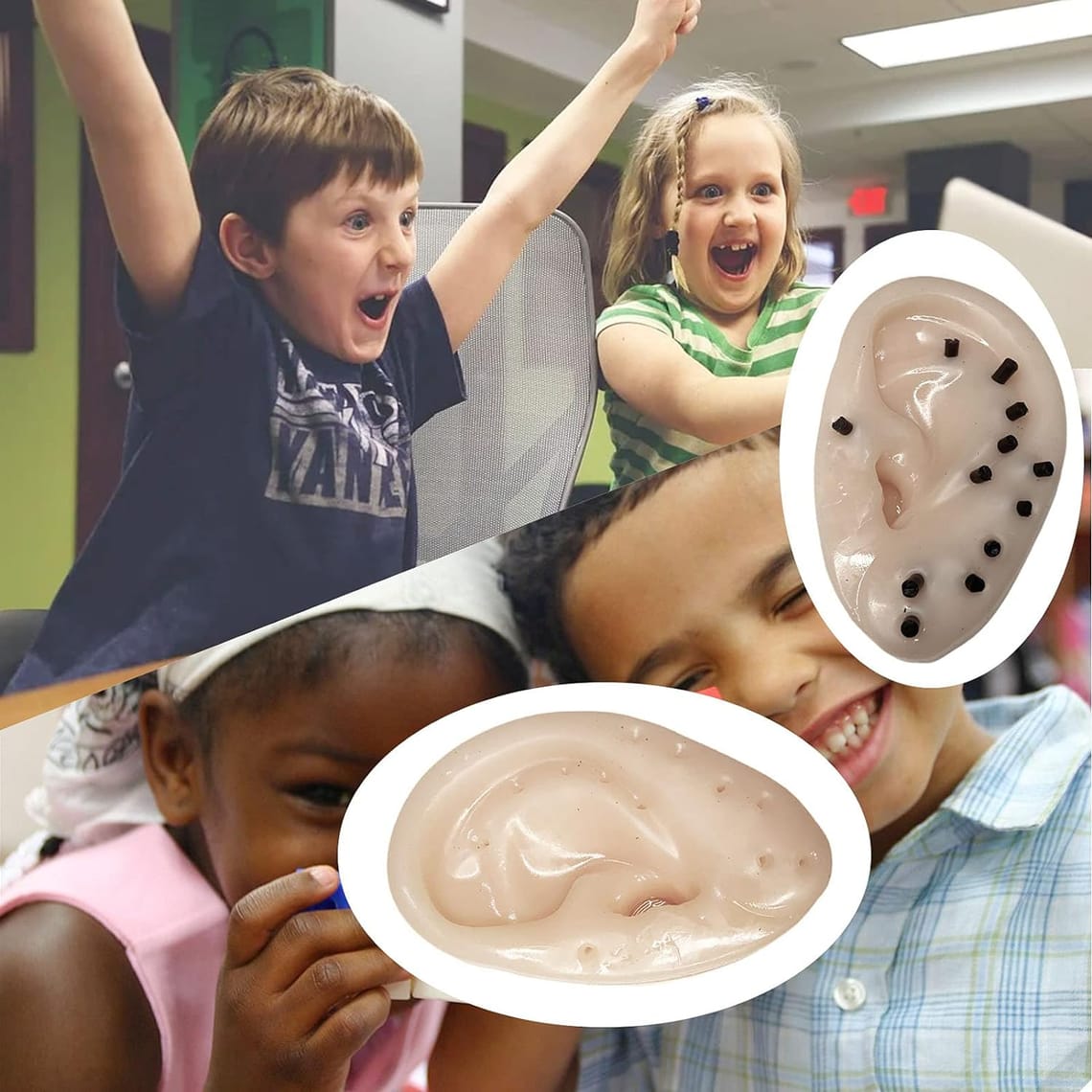 Is This Gross Pimple Toy Actually a Great Stress Buster?